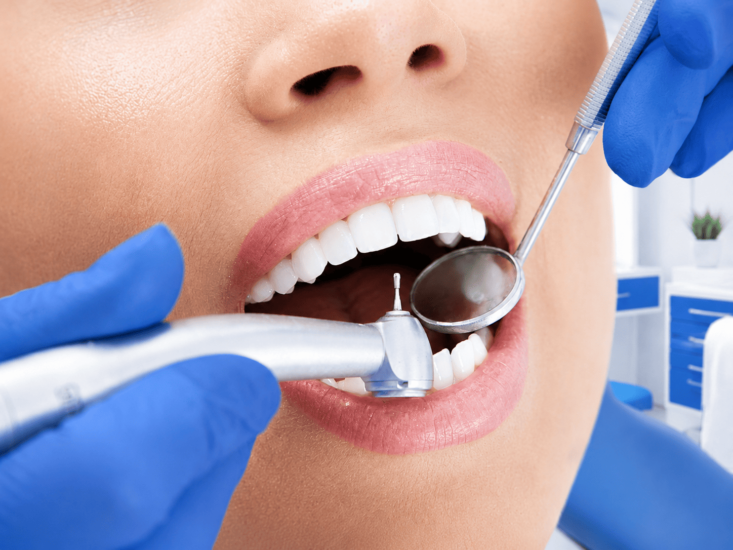Limpieza dental